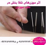 طب سوزنی دکتر فتانه نیکو