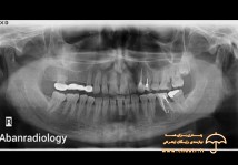 رادیولوژی دندان، فک وصورت آبان