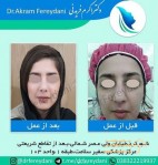 دکتر اکرم فریدنی متخصص گوش حلق بینی