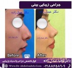 دکتر مجید عبدل زاده جراحی بینی