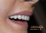 دکتر وحید دهقان متخصص جراحی فک و صورت و زیبایی