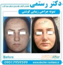 دکتر نصیبه رستمی جراح بینی