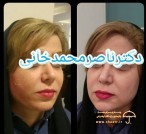 دکتر محمدخانی جراحی و زیبایی