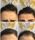 دکتر راحله انتظاری متخصص پوست مو زیبایی