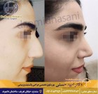 دکتر امید حسنی جراحی زیبایی