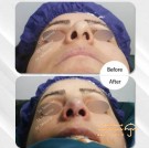 dr-taherinia-nose-plastic-surgery