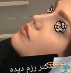 دکتر روح اله رزم دیده جراحی زیبایی بینی شیراز