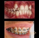 دکتر فرزانه خواجه متخصص ارتودنسی
