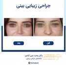  دکتر وحید عین آبادی جراحی زیبایی