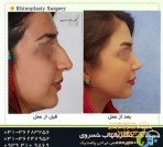 nose-beauty-surgery-doctor