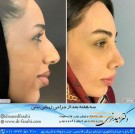 دکتر سعید فرهی جراحی زیبایی بینی بابل