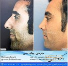 دکتر سعید فرهی جراحی زیبایی بینی بابل