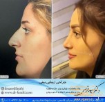 دکتر سعید فرهی جراحی زیبایی بینی بابل