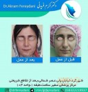 دکتر اکرم فریدنی متخصص گوش حلق بینی