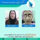 دکتر اکرم فریدنی متخصص گوش حلق بینی