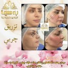 beauty-clinic-behsima-hamedan-skin-care