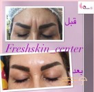 مرکز زیبایی و پوست های شاداب