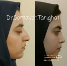 دکتر سمیه طریقت جراح پلاستیک بینی و صورت