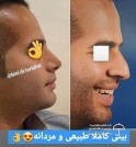 دکتر سمیه طریقت جراح پلاستیک بینی و صورت