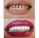 beauty-clinic-teeth-dental-sanandaj