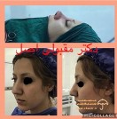 دكتر داود مقبولى اصل جراح زيبايى بينى و صورت